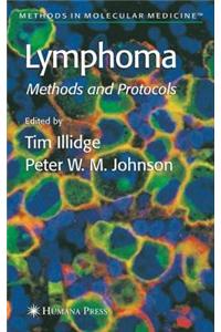 Lymphoma: Methods and Protocols. Methods in Molecular Medicine.
