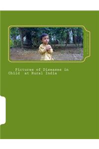 Pictures of Diseases in Child at Rural India