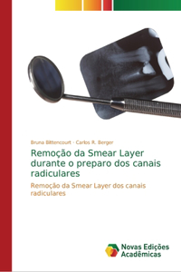Remoção da Smear Layer durante o preparo dos canais radiculares