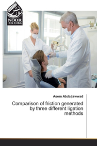 Comparison of friction generated by three different ligation methods