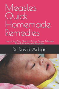 Measles Quick Homemade Remedies