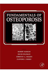 Fundamentals of Osteoporosis