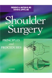 Shoulder Surgery: Principles and Procedures