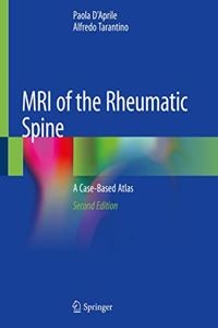 MRI of the Rheumatic Spine