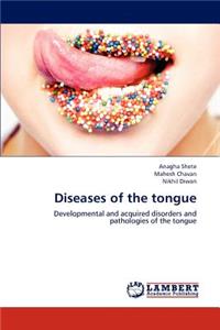 Diseases of the tongue