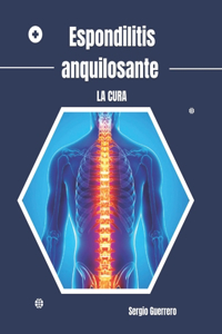 Espondilitis anquilosante