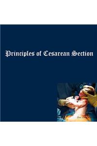 Principles of Cesarean Section