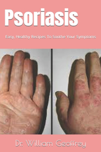 Psoriasis