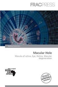 Macular Hole