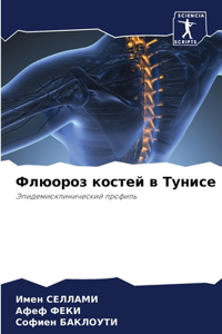 Флюороз костей в Тунисе