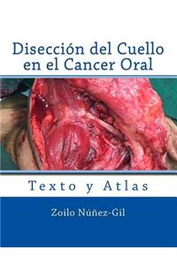 Diseccion del Cuello en el Cancer Oral