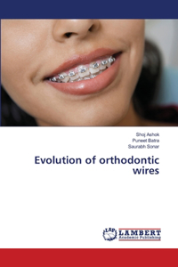 Evolution of orthodontic wires