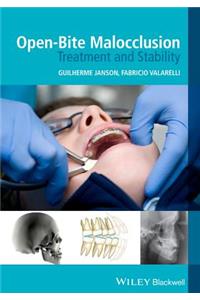 Open-Bite Malocclusion