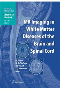 MR Imaging in White Matter Diseases of the Brain and Spinal Cord