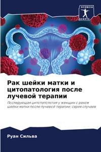 Рак шейки матки и цитопатология после лучk