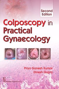 Colposcopy in Practical Gynecology