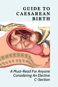 Guide To Caesarean Birth