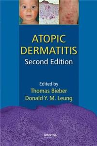 Atopic Dermatitis