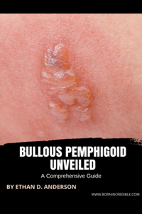 Bullous Pemphigoid Unveiled