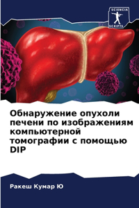 Обнаружение опухоли печени по изображен