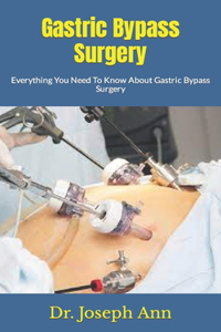 Gastric Bypass Surgery