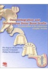 Osseointegration and Autogenous Onlay Bone Grafts: Reconstruction of the Edentulous Atrophic Maxilla