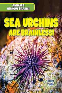 Sea Urchins Are Brainless!