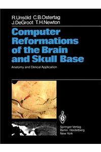 Computer Reformations of the Brain and Skull Base