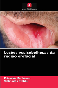 Lesões vesicobolhosas da região orofacial