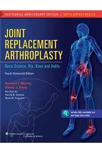 Joint Replacement Arthroplasty