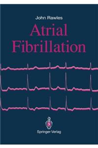 Atrial Fibrillation