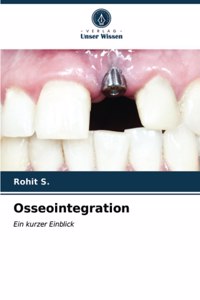 Osseointegration