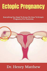 Ectopic Pregnancy