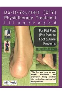 Physiotherapy Treatment Illustrated For Flat Feet (Pes Planus) Foot & Ankle Problems