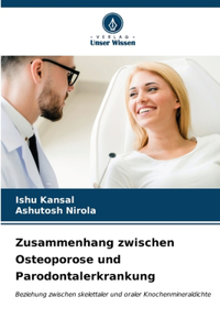 Zusammenhang zwischen Osteoporose und Parodontalerkrankung