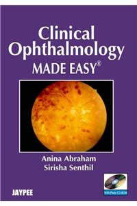 Clinical Ophthalmology Made Easy with Photo CD-ROM