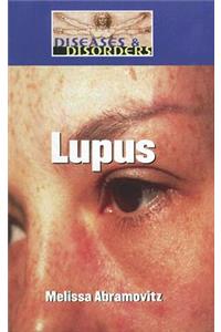 Lupus