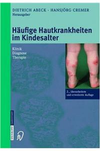 Hdufige Hautkrankheiten Im Kindesalter: Klinik - Diagnose - Therapie