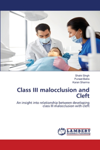 Class III malocclusion and Cleft