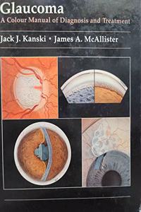 Glaucoma: A Colour Manual of Diagnosis and Treatment