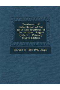 Treatment of Malocclusion of the Teeth and Fractures of the Maxillae: Angle's System