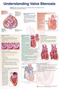 Valve Stenosis