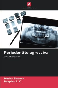 Periodontite agressiva