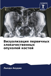 Визуализация первичных злокачественных &