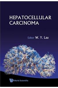 Hepatocellular Carcinoma