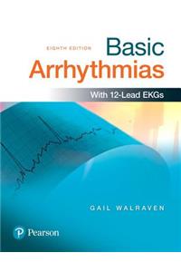 Basic Arrhythmias