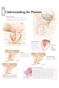 Understanding the Prostate Laminated Poster