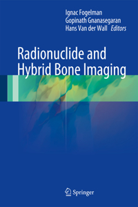 Radionuclide and Hybrid Bone Imaging