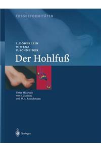 Fussdeformitäten: Der Hohlfuss