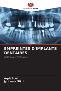 Empreintes d'Implants Dentaires